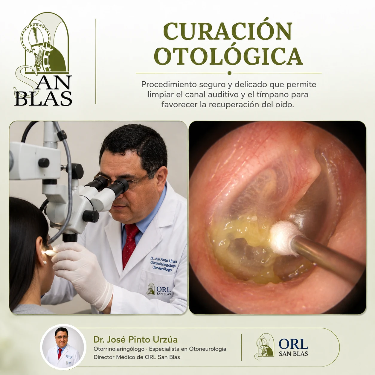 Curación otológica en ORL San Blas, material educativo para pacientes