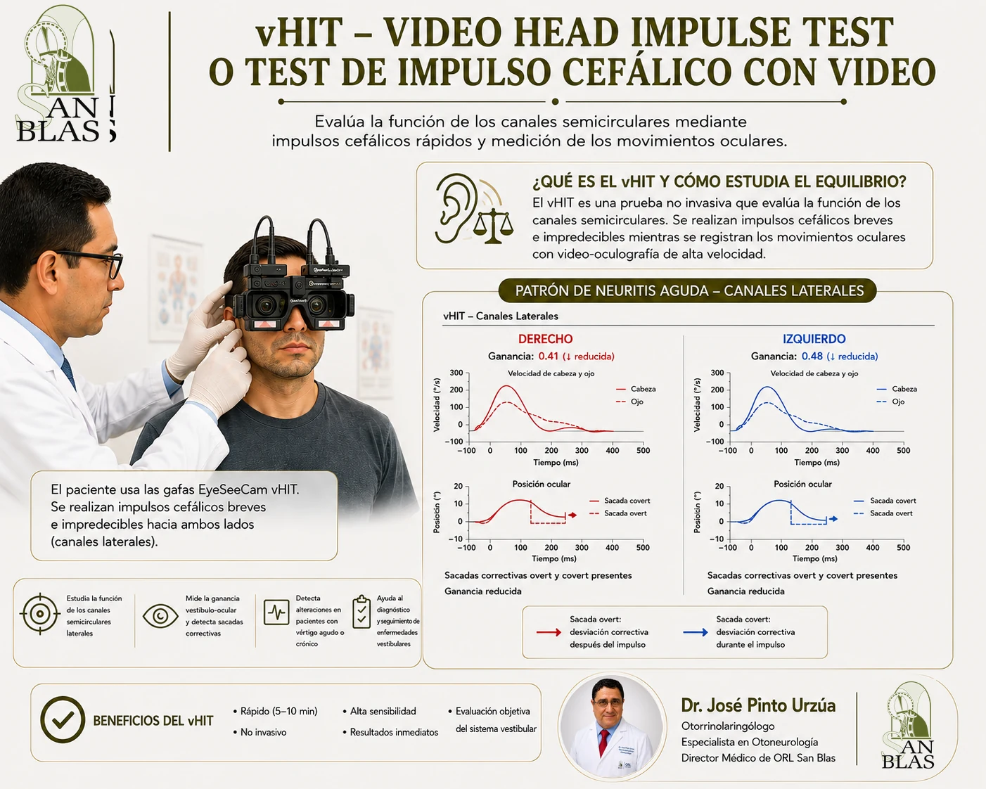 vHIT / Video Head Impulse Test en ORL San Blas, material educativo para pacientes